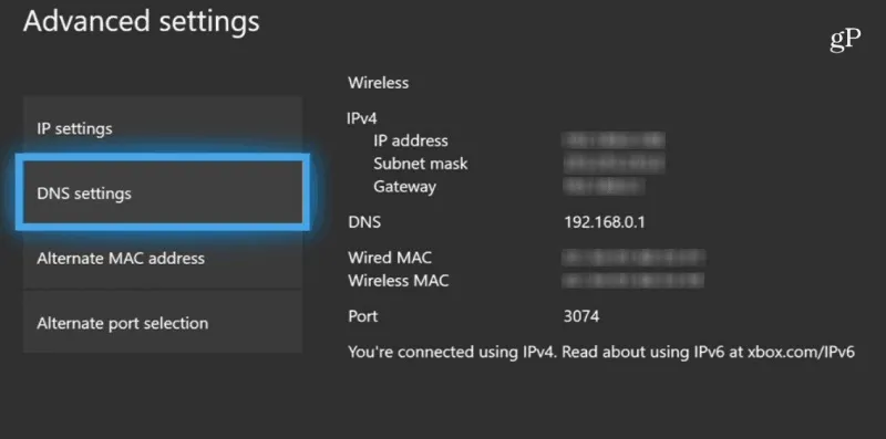 DNS Settings Xbox